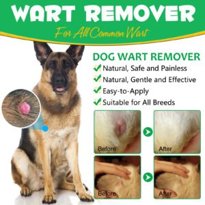 Wart Remover