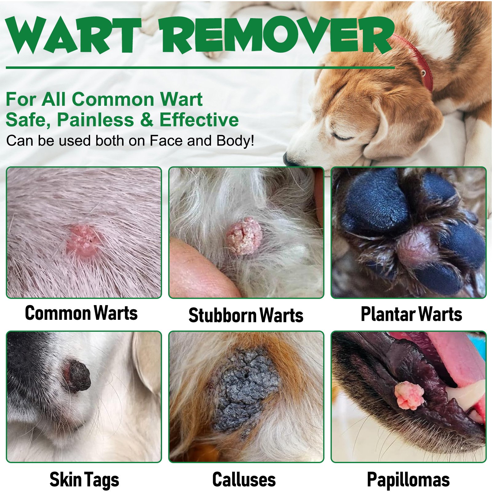 Wart Remover - Image 8